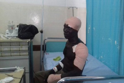 Paul Olyel 47 one of the injured at St Mary's Hospital Lacor.