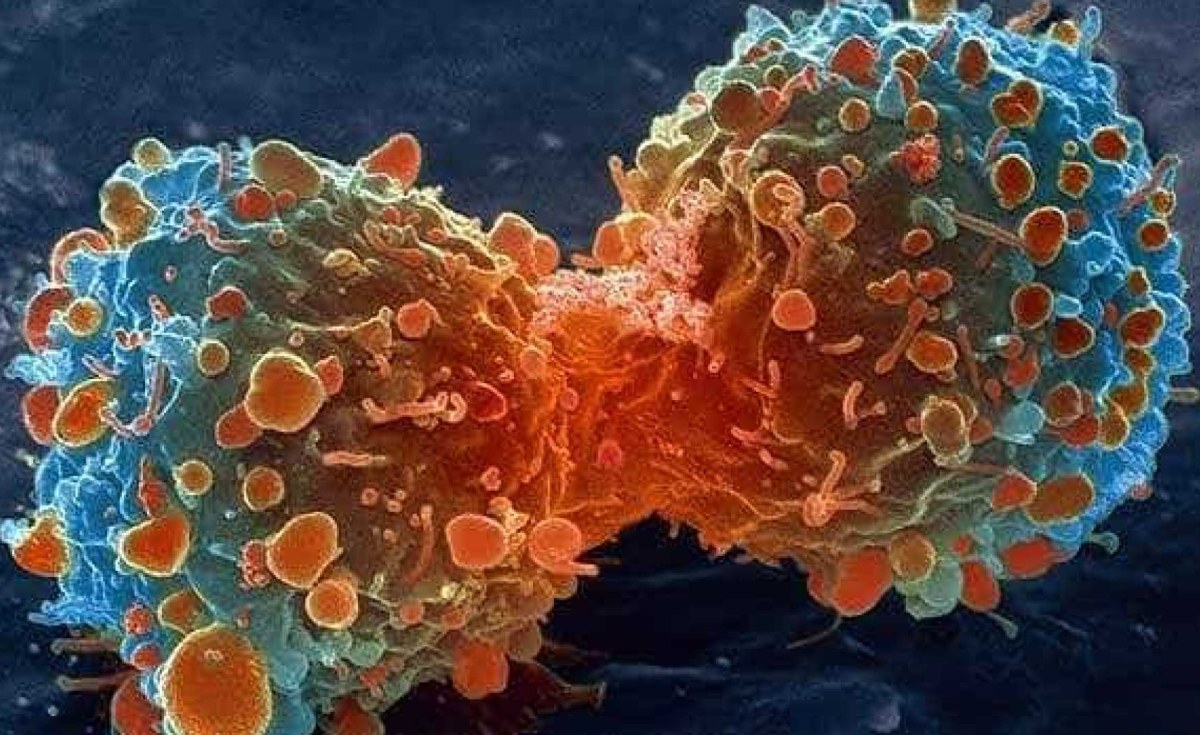 Africa: South African Scientists Make Breakthrough in Decoding Cancer's Most Effective Survival Strategy