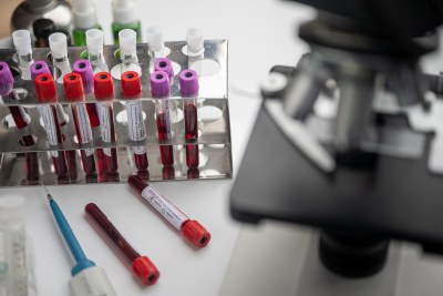 Coronavirus testing (file photo).