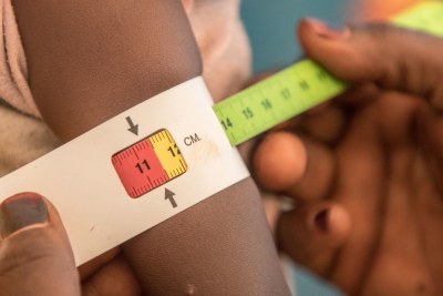 Many young children are suffering the effects of malnutrition.