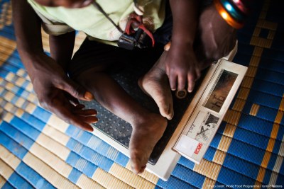 The 2020 Global Nutrition Report looks beyond global and national patterns, revealing significant inequalities in nutrition outcomes within countries and populations.