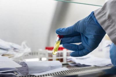 Des tests de diagnostic rapide à base d'antigènes approuvés par l'OMS pour le nouveau coronavirus en Afrique ont été mis en place.