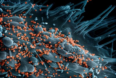 Lassa virus (file photo).