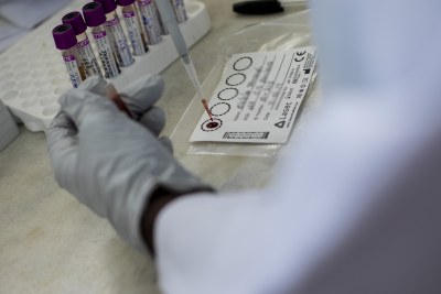 José Manuel, a MSF lab technician, conducts tests to check patient's viral load (file photo).