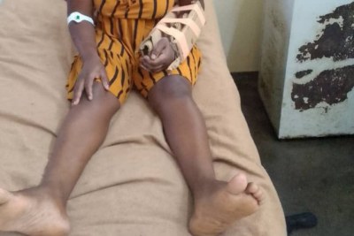 Images of accident victims in “cardboard casts” spark public outrage.