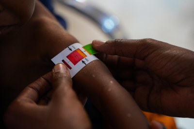 An MSF staff measures the mid-upper arm circumference of a baby to assess the level of malnutrition at the MSF-run decentralised outreach centre near Elbet-I camp in Baidoa. Somalia, June 2024.